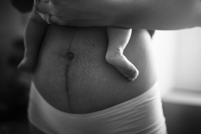 postpartum healing essentials